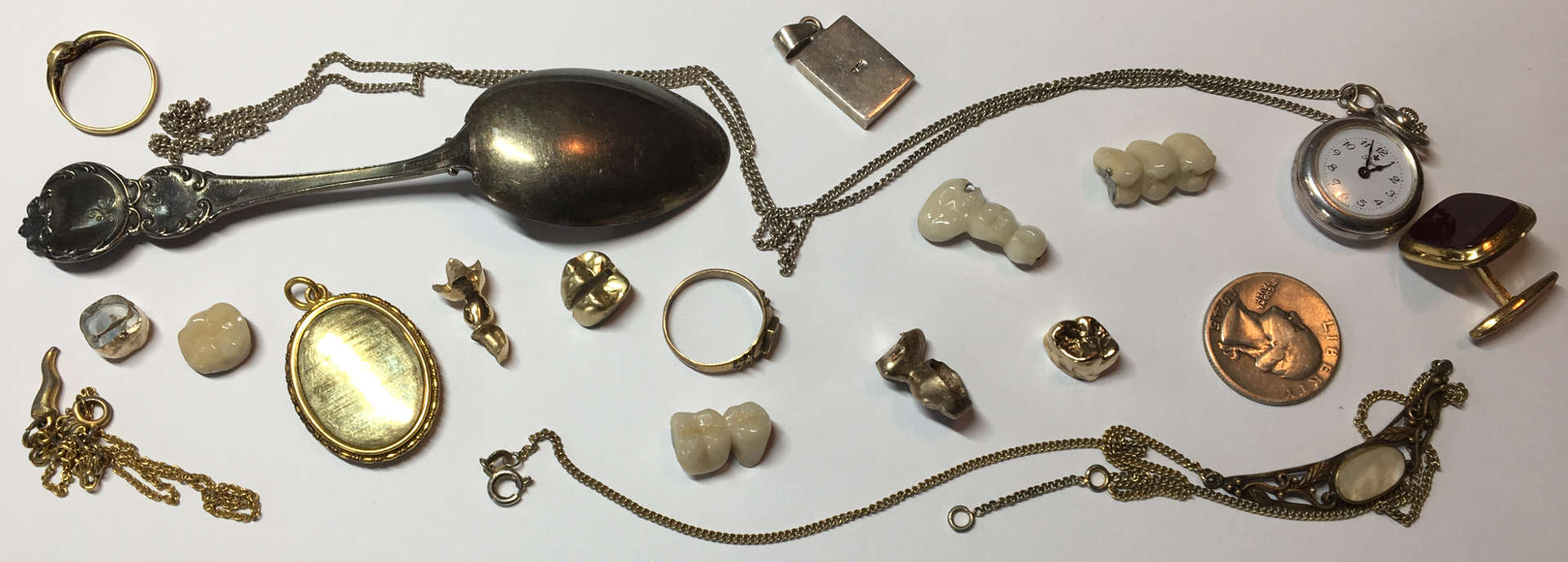 Zahngold Ankauf